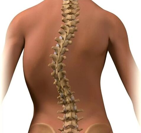 ជំងឺ Scoliosis