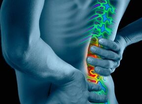 មូលហេតុនិងរោគសញ្ញានៃជំងឺ osteochondrosis
